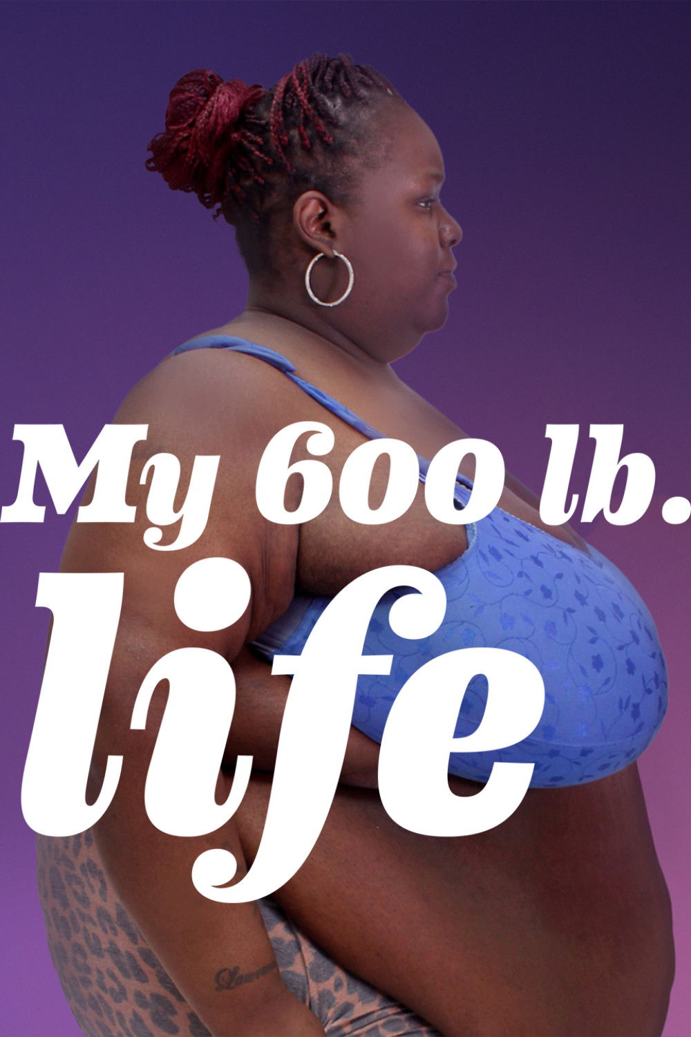 Mi vida con 300 kilos