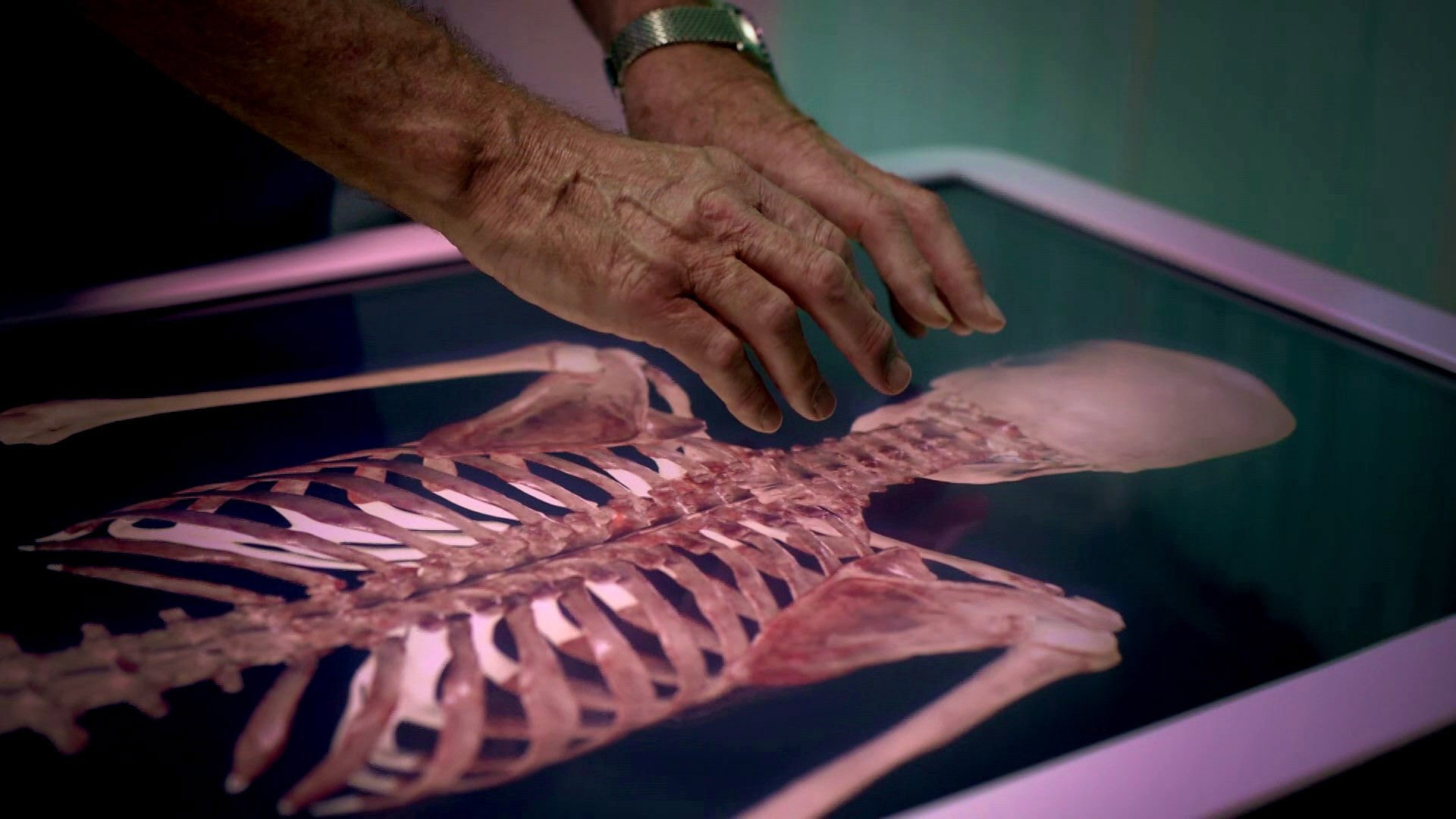 ¿Un atropello y fuga?